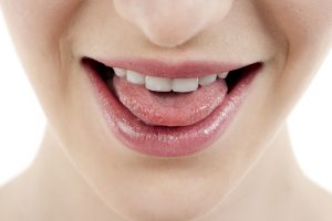 Podcięcie wędzidełka - chirurgia stomatologiczna -zabiegi stomatologii estetycznej